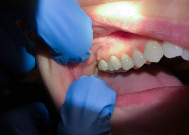 Best Walk-In Emergency Dental Services in Simpsonville, SC